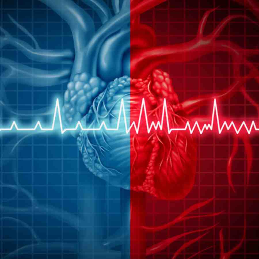 Three ways to keep your arteries clean dgtl