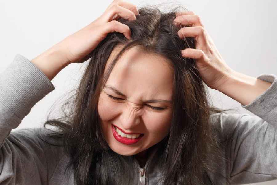 how to avoid fungal infection in scalp due to excessive sweating in summer and deal with hair fall problem dgtl