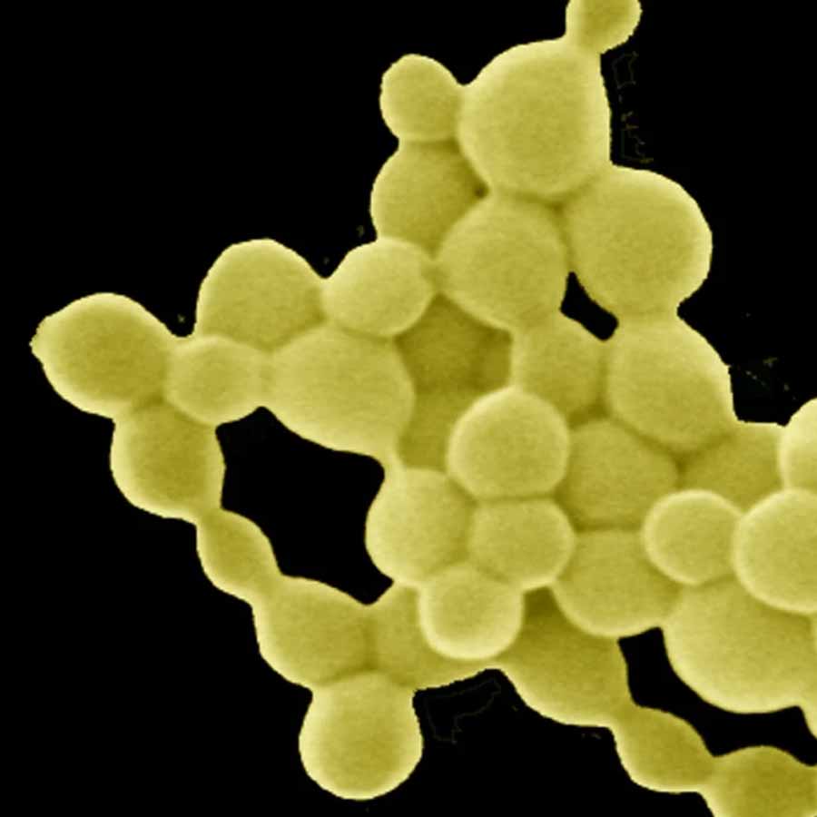 Metal-gobbling Bacteria