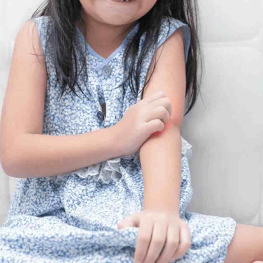 Tips to Manage Allergies During Monsoon dgtl