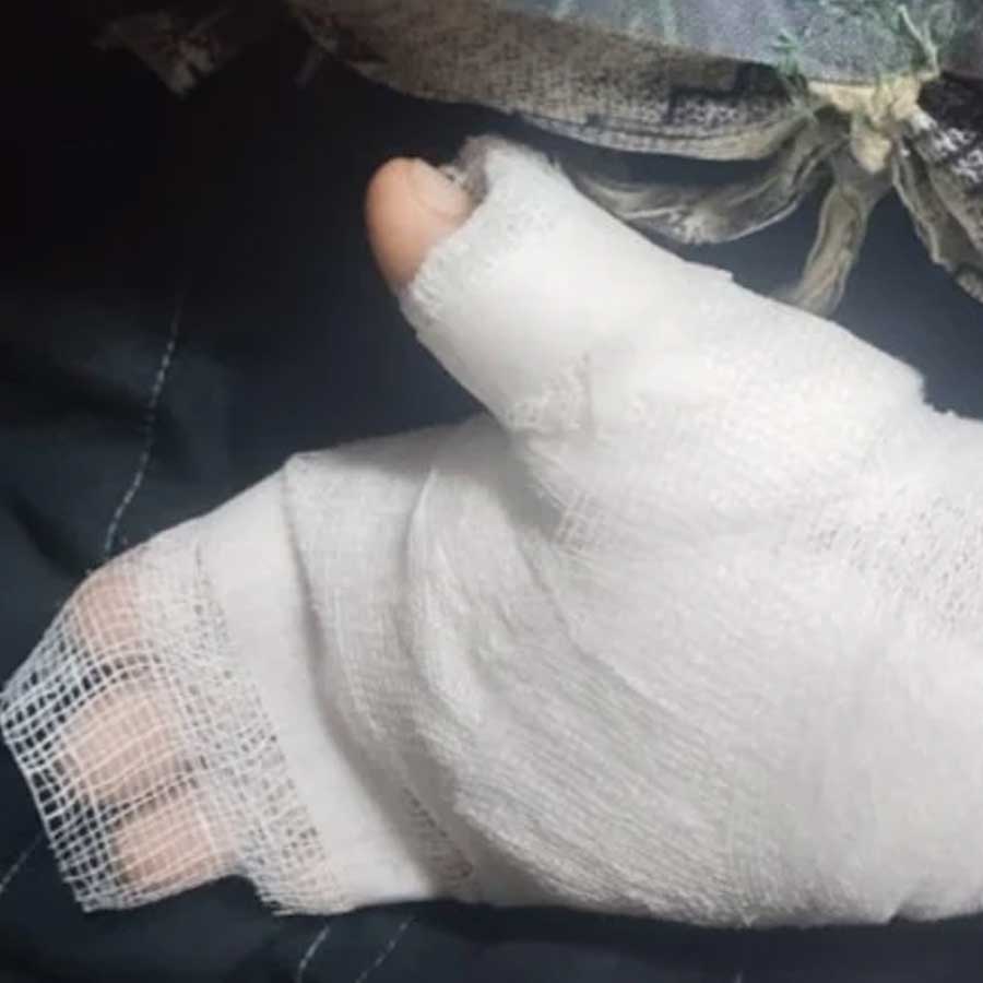 Teacher allegedly burnt student hand for bad handwriting dgtl