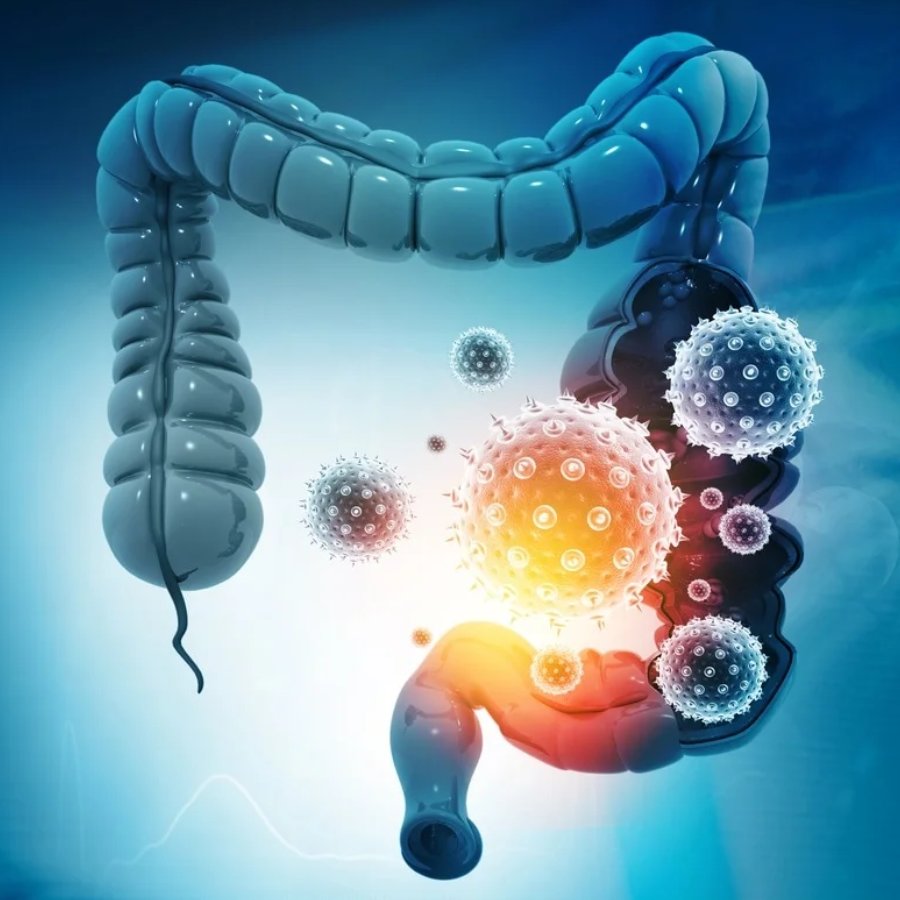 Nutritionist says Gut plays an important role in Catching cold and 5 food can keep it healthy  dgtl