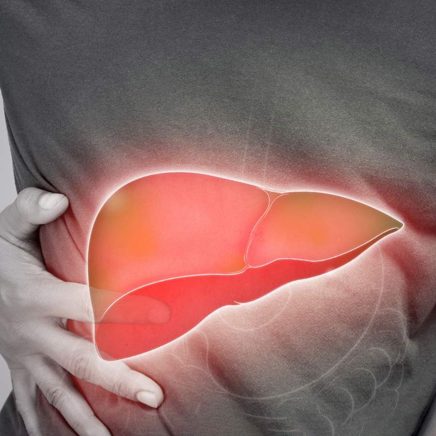 To reverse fatty liver one can follow these 5 tips