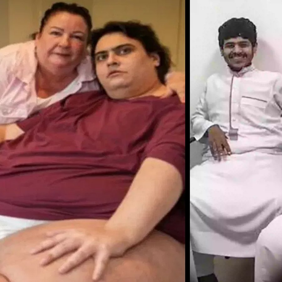 Story of Unbelievable 542 kg weight loss of once world’s heaviest man Khalid Bin Mohsen Shari dgtl
