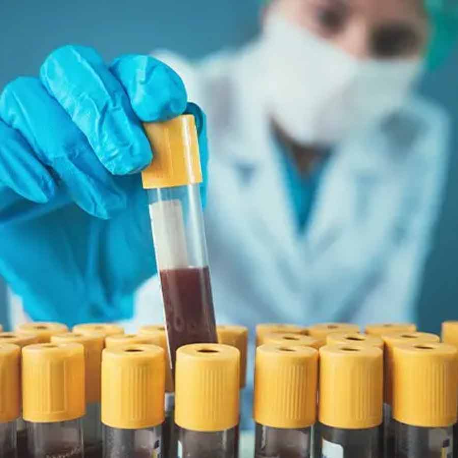 কৃত্রিম রক্ত তৈরি করছেন জাপানি বিজ্ঞানীরা।