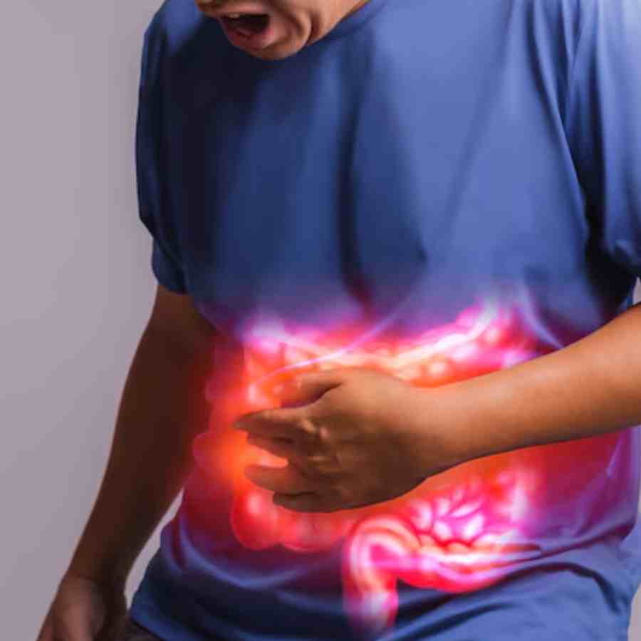 Appendix Cancer is on rise among young adults, why early detection is necessary