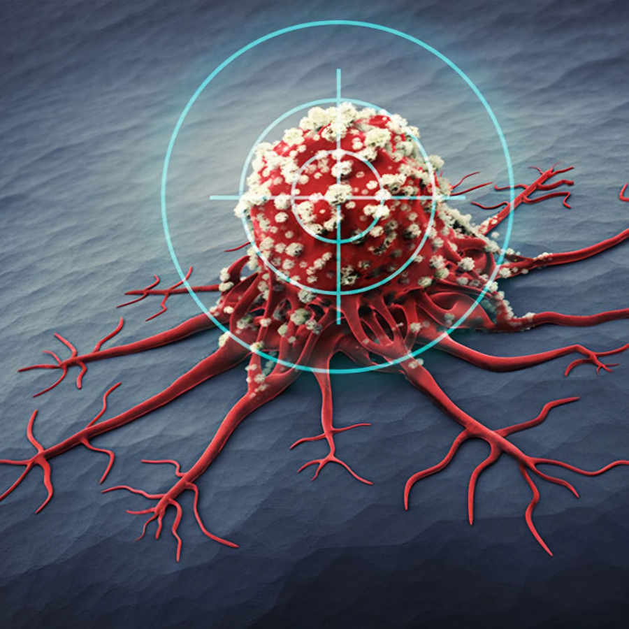 Study finds new way to reduce Cancer recurrence risk dgtl