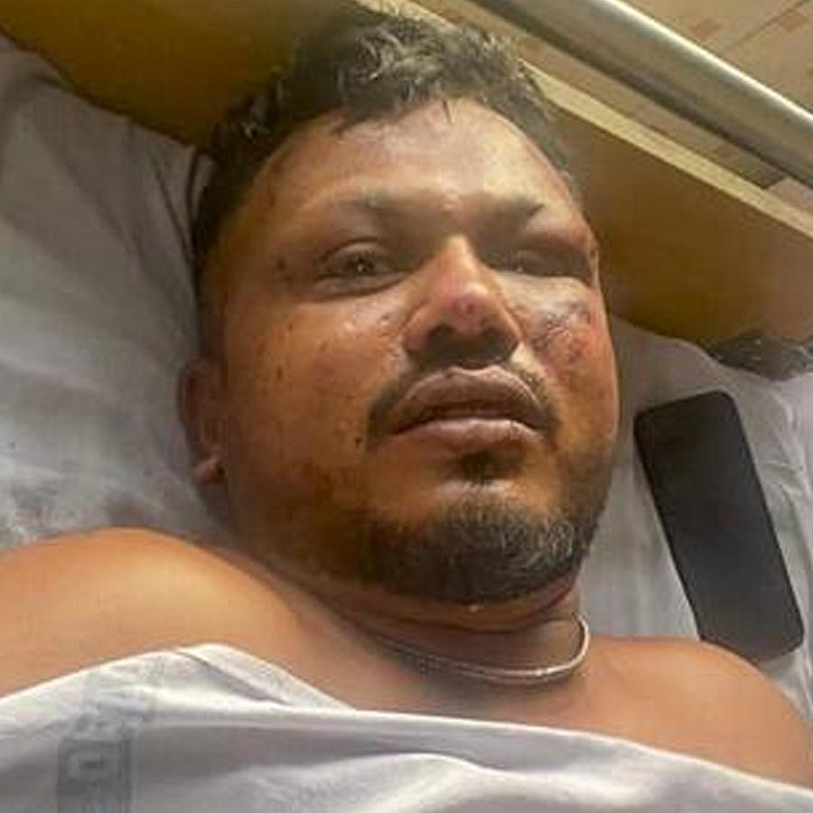 All About Vishwash Kumar Ramesh, the Only Survivor from Seat 11A in Ahmedabad Plane Crash