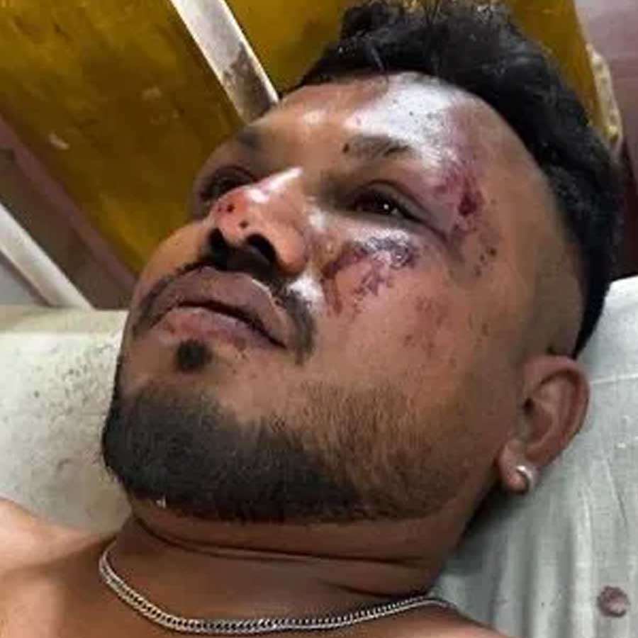 All About Vishwash Kumar Ramesh, the Only Survivor from Seat 11A in Ahmedabad Plane Crash