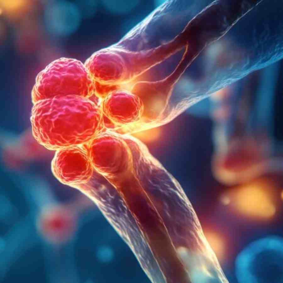 What are the unknown symptoms of Bone Cancer