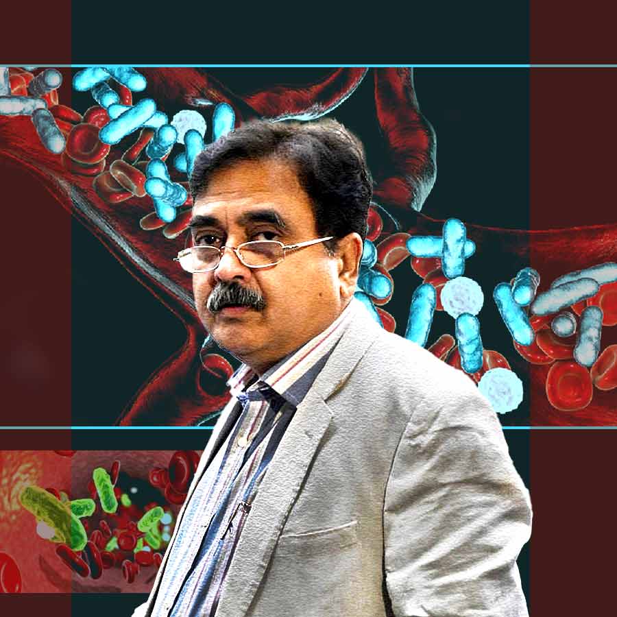 what is GI sepsis or gastrointestinal sepsis that Former Justice and BJP MP Abhijit Ganguly is Suffering from dgtl