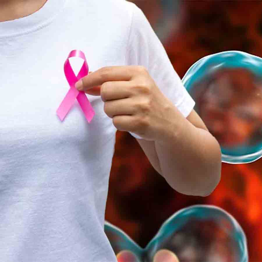 Breast cancer if diagnosed in time there is a high chance of recovery, but government hospitals lacks those infrastructure