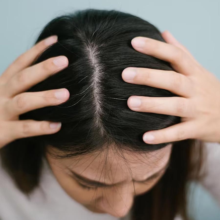 Simple remedies for greasy hair and itchy scalp dgtl