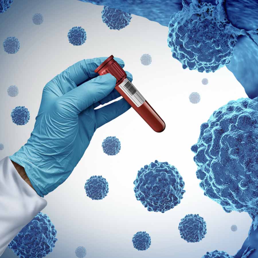 A new study revealed that special blood test can detect cancer years before symptoms