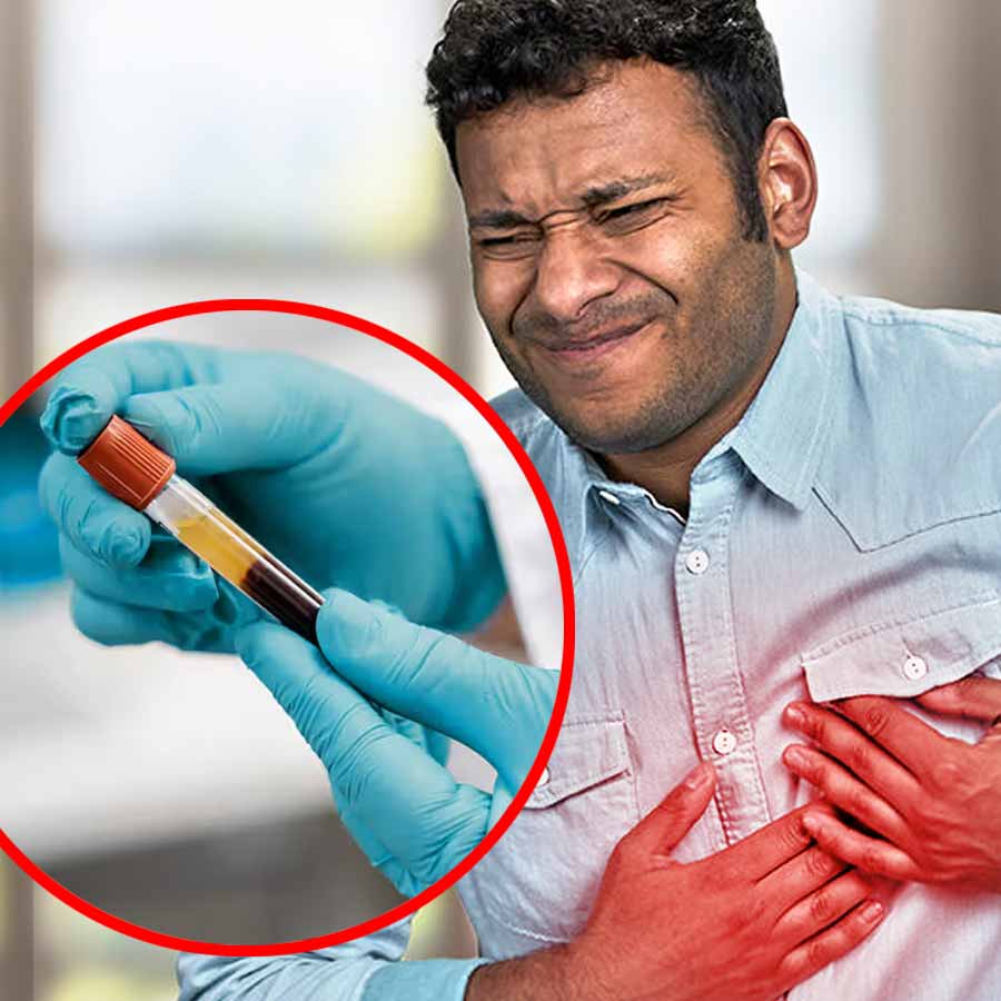 These Two blood tests can detect a future Heart Attack