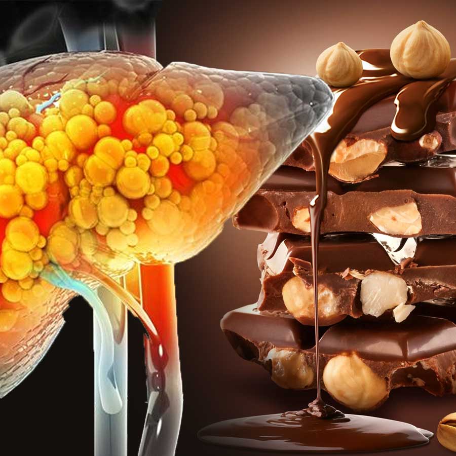4 snacks can reverse fatty liver said doctors dgtl