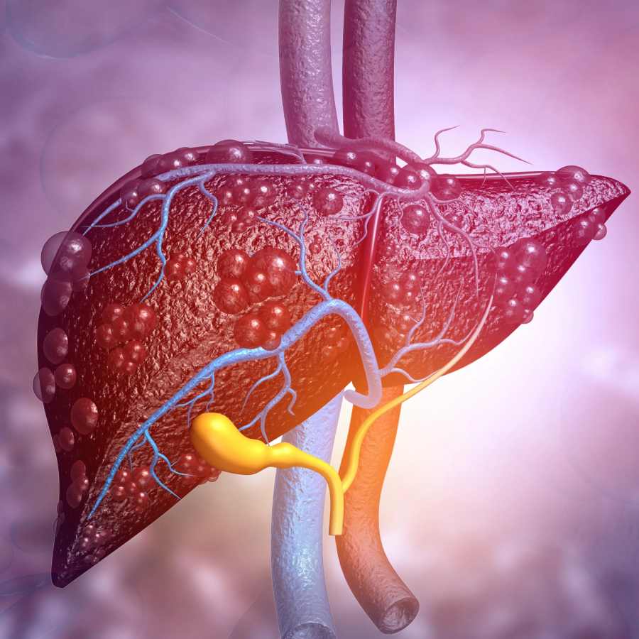 Experts say A detox water for liver cleansing may be effective for liver cleansing dgtl