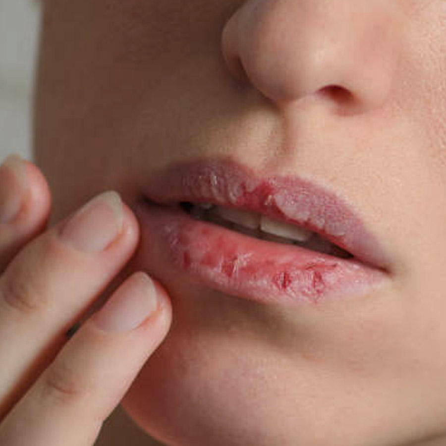 How to get soft pink lips at home with 7 easy tricks dgtl