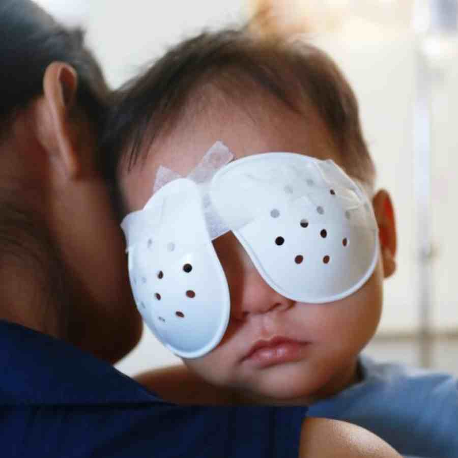 ছানি নিয়েই জন্মাতে পারে শিশু।