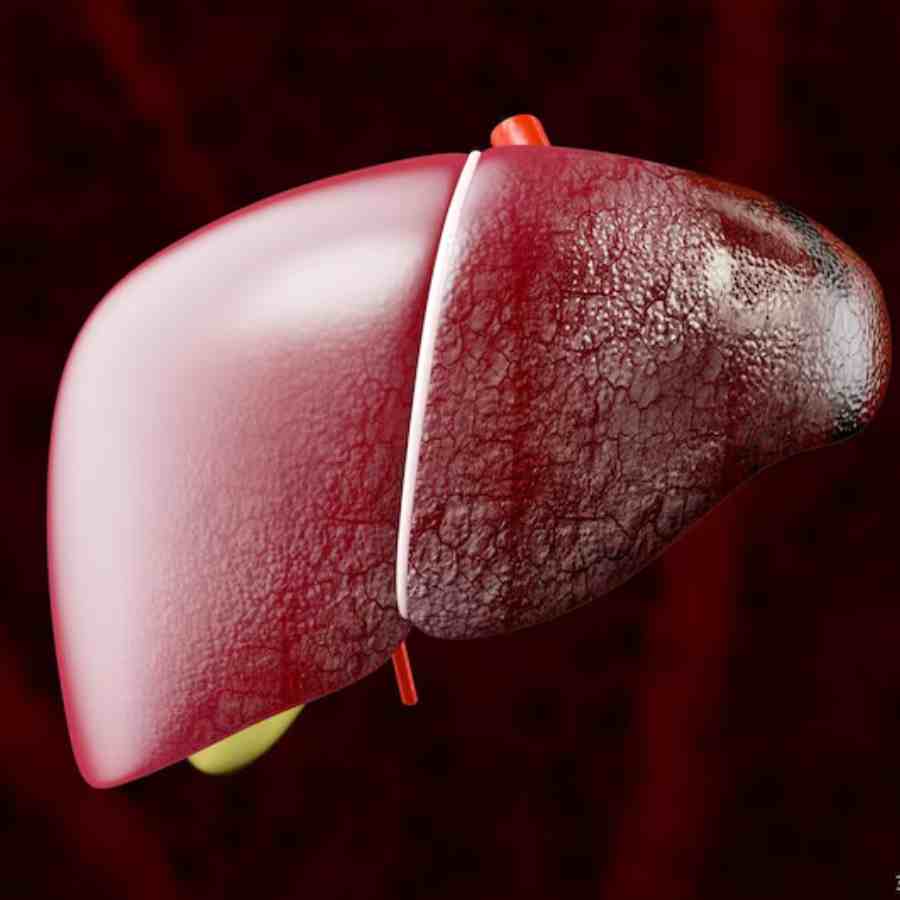 A Very basic habit to keep your Liver Clean and infection free dgtl