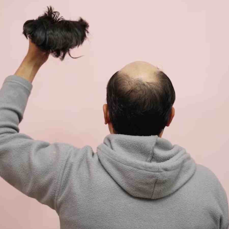 How to use Olive Oil to regrow hair on bald patches