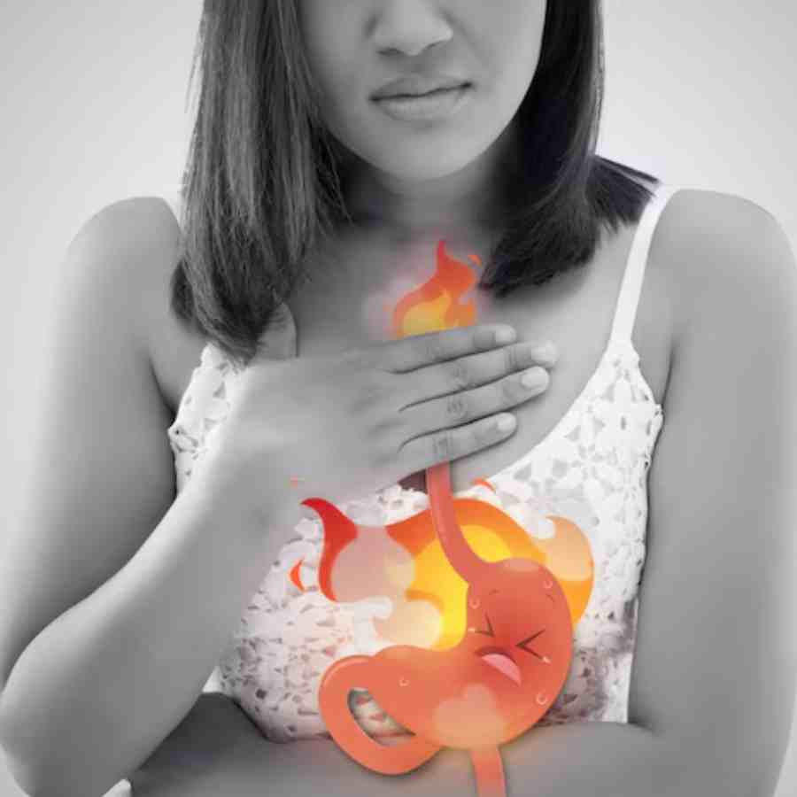 Frequent acid reflux and bloating may not be just gut issues, signaling more serious condition like a hiatus hernia