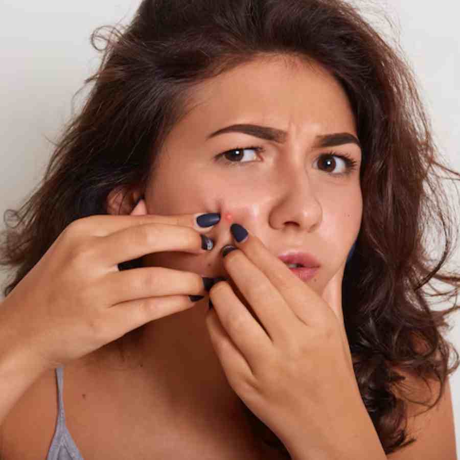 5 foods responsible for triggering acne and rash dgtl