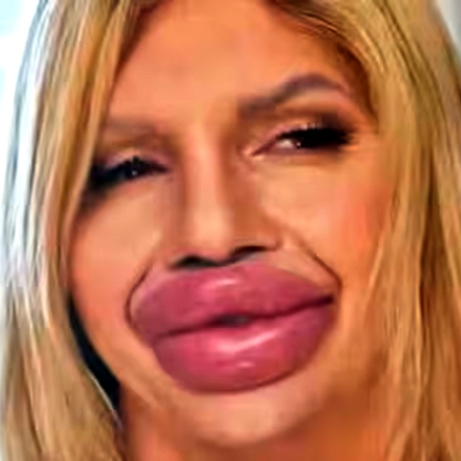Spanish Influencer who claims to have biggest lips in the world, want to make it bigger