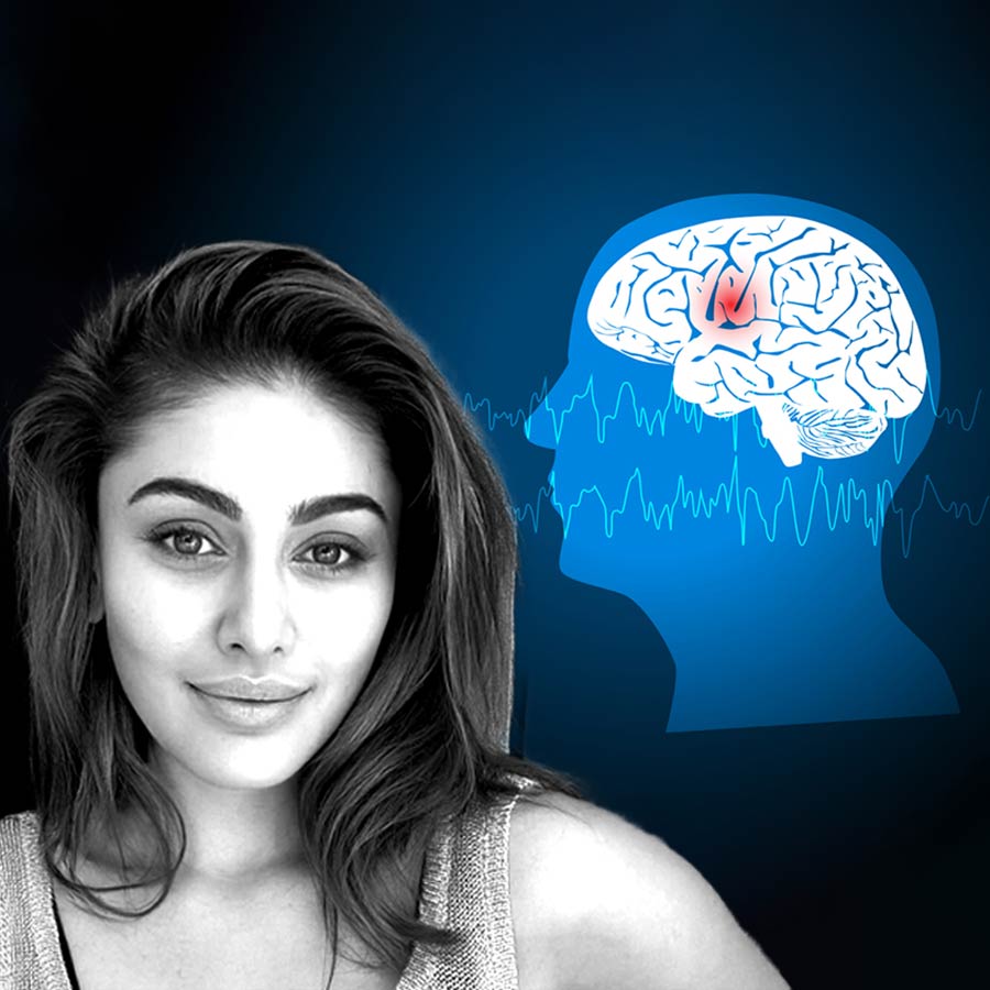 Late Actress Shefali Jariwala once revealed she had epileptic seizure due to anxiety, doctor explained the disease dgtl