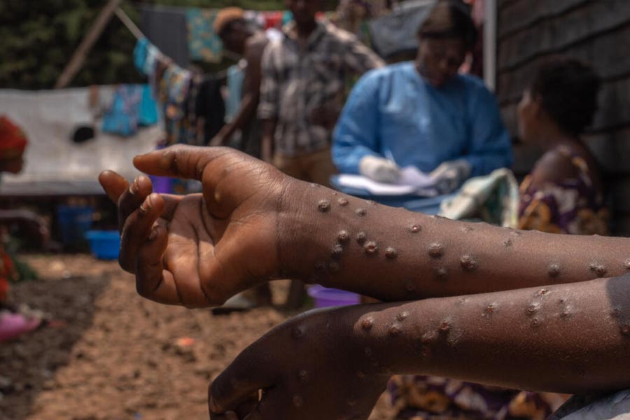 mysterious illness has emerged in Congo 