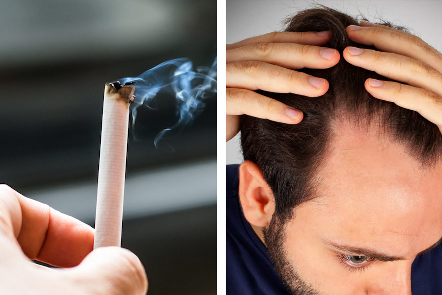 Does smoking cause hair loss, Here’s how it may affect your hair