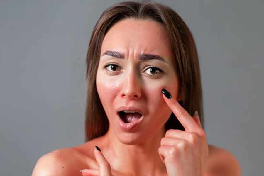 Hyaluronic acid is good for acne prone skin what is saying expert dgtl