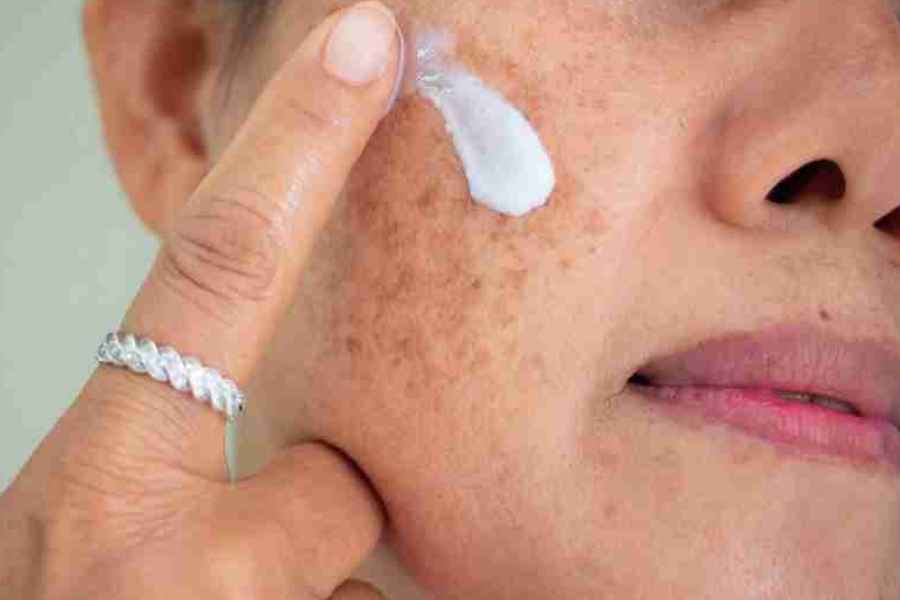 These face packs can cure open pores problems in women after menopause