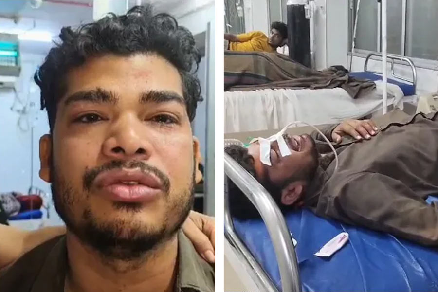 আহত সেই যুবক শৈলেন্দ্র গুপ্ত।