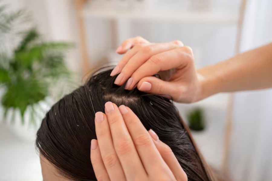 Using this oil for dandruff is an effective way to get quick results