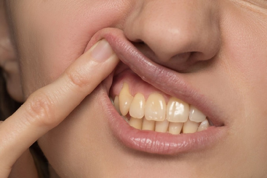 Tips of dental oral care, how to remove stains from teeth at home