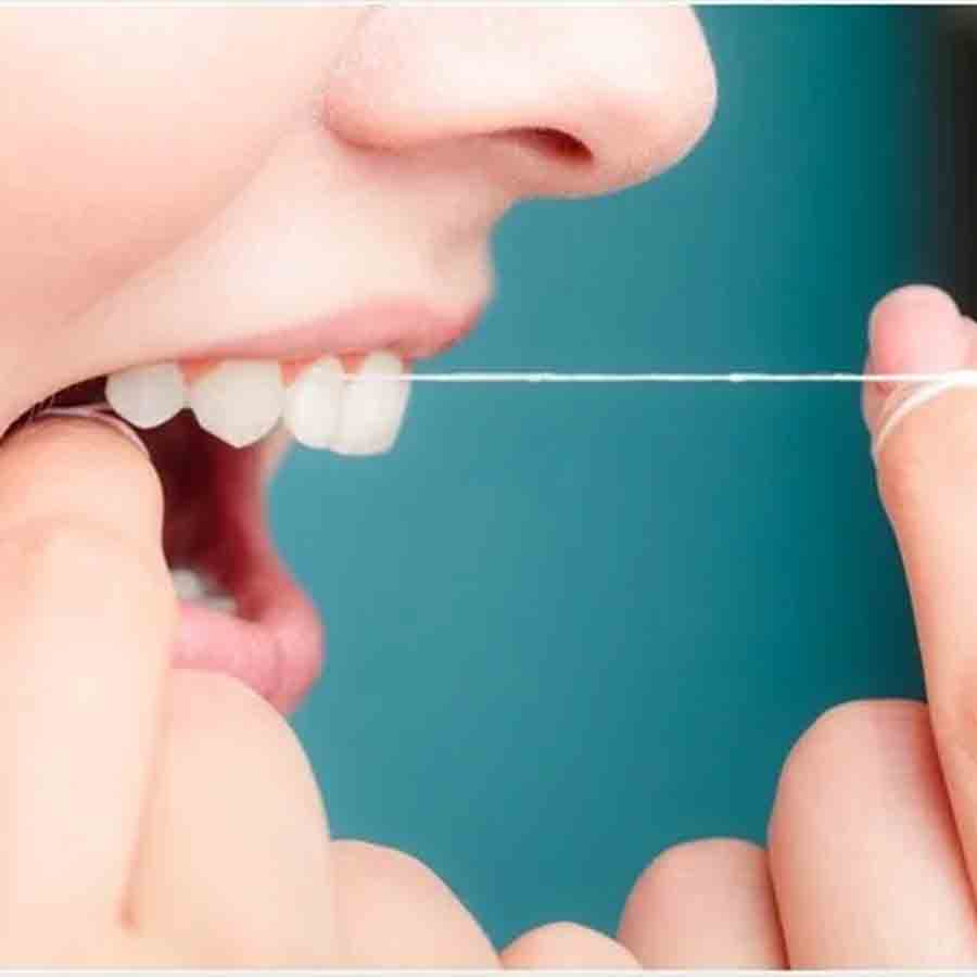 ডেন্টাল ফ্লস ব্যবহার করার পরামর্শ চিকিৎসকের।