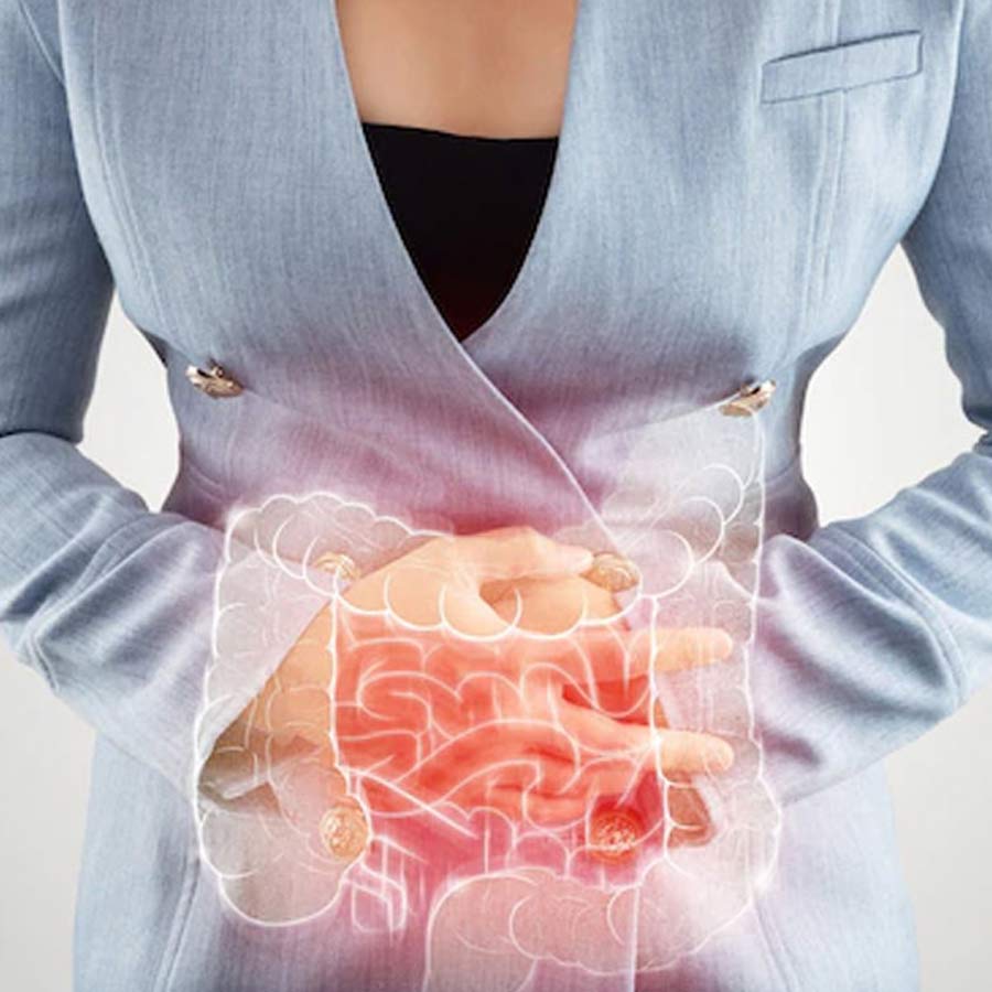 Five gut easy snacks for people with constipation and ibs problems