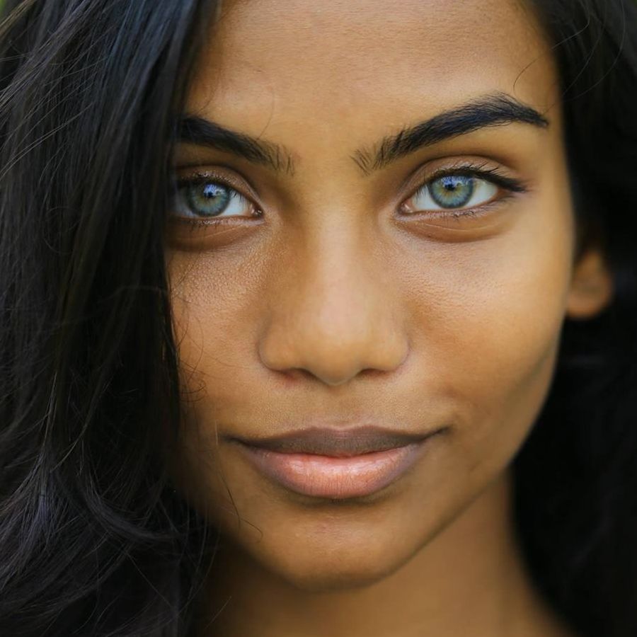 Avoid popping pimple in the dangerous triangle of face as it can cause severe infection that may reach your brain dgtl