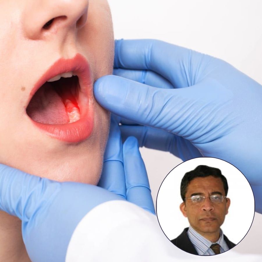 Not just smoking! Do you know what other causes can lead to oral cancer? dgtl