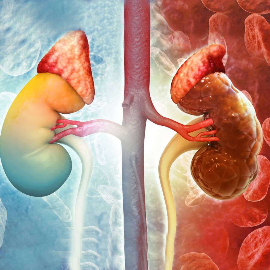 5 signs that is telling your kidney is not in very good shape dgtl
