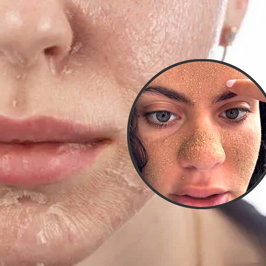 What is caveman skincare trend which is taking over internet all over the world