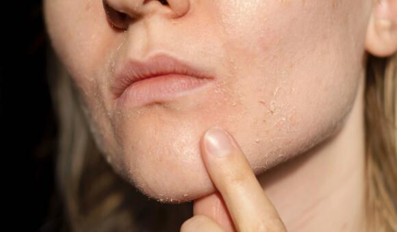 What is caveman skincare trend which is taking over internet all over the world