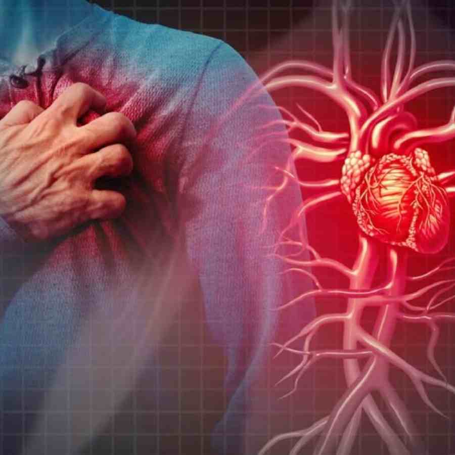 The Less popular test CT Calcium score is important to detect Heart Attack