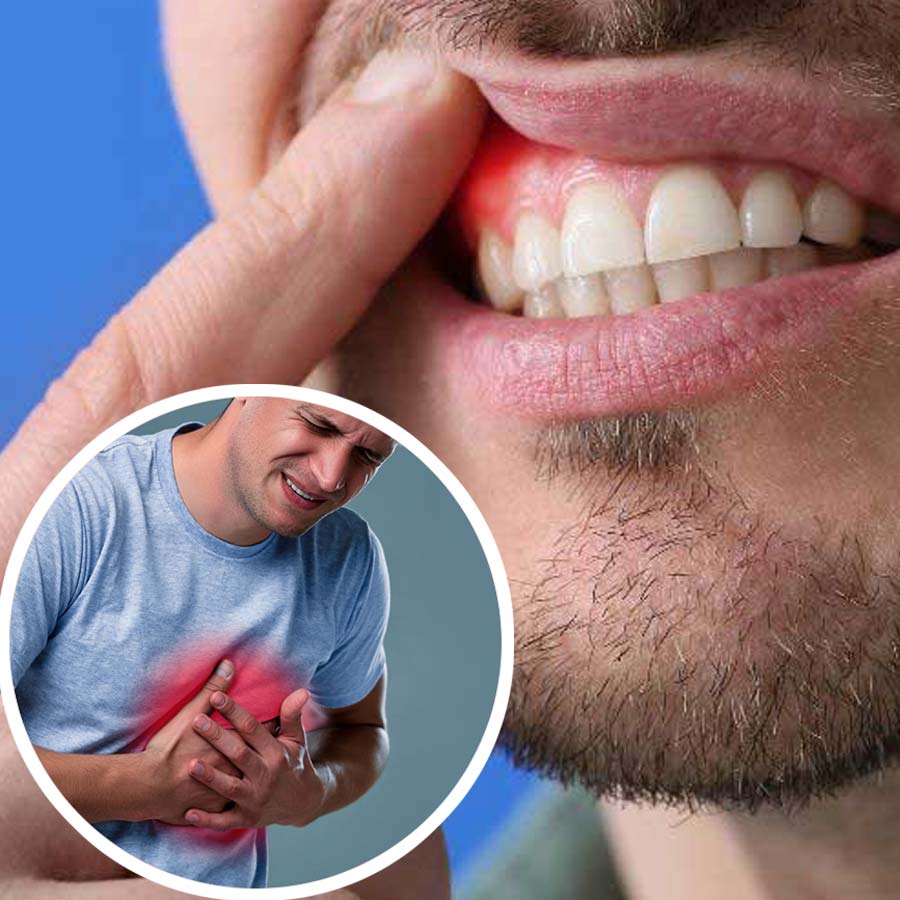 Poor Oral health can have ill effects on the heart, claims cardiologist and dentist dgtl