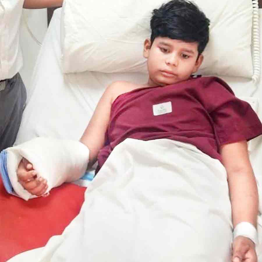 A private hospital successfully joined a severed hand of a 14 years old boy