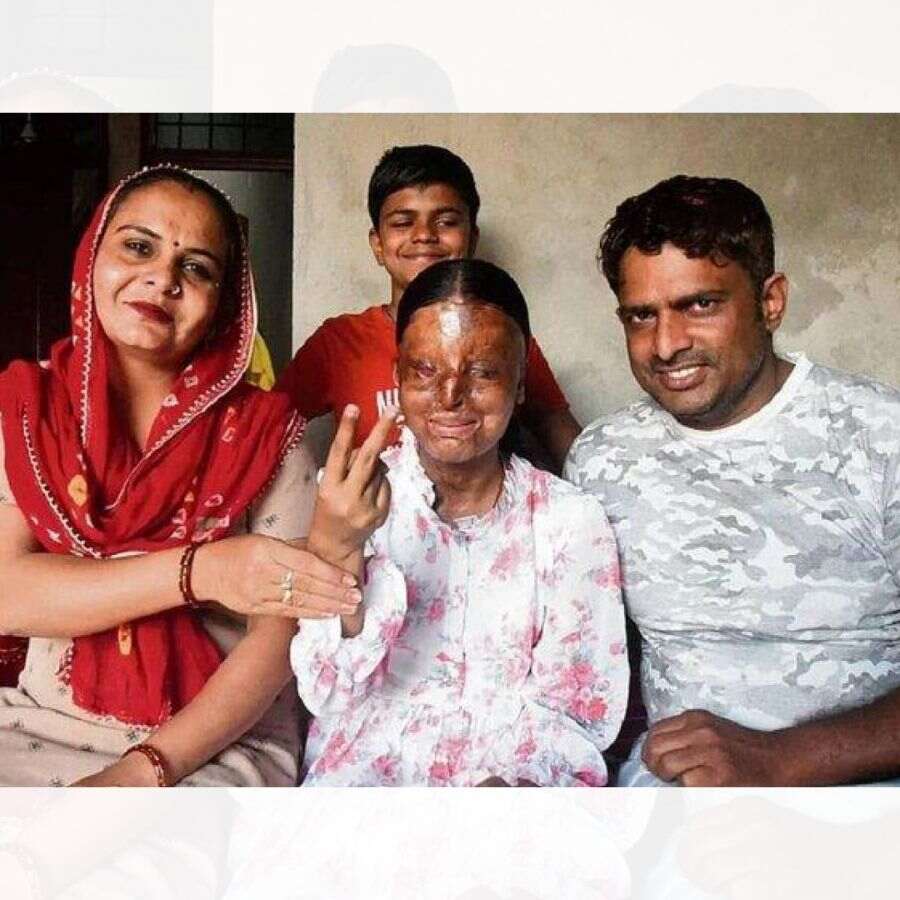 Chandigarh acid attack survivor with her family. 