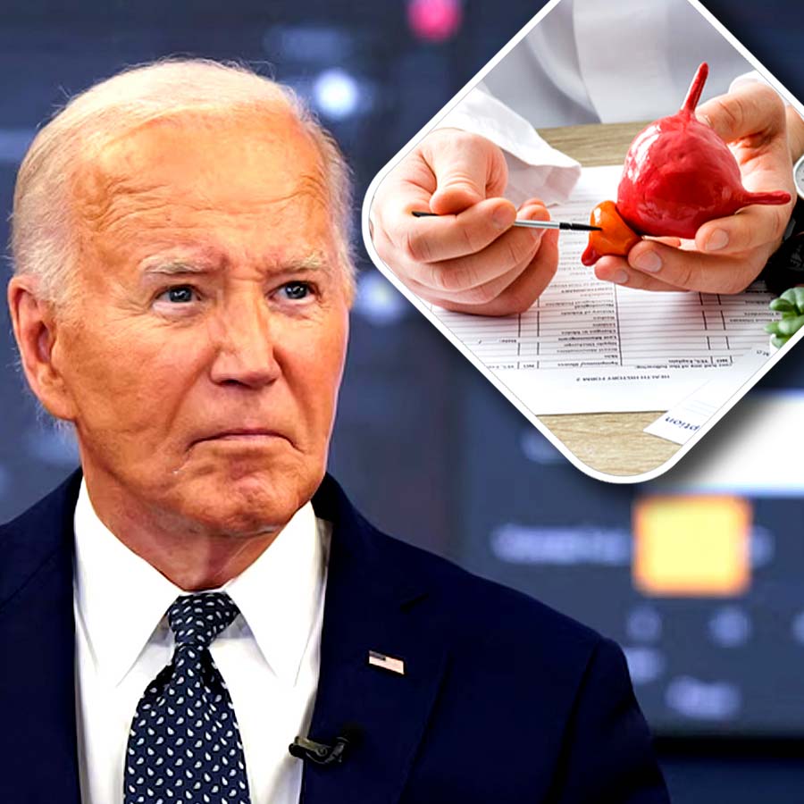 Former USA President Joe Biden’s prostate cancer diagnosis according to Gleason score