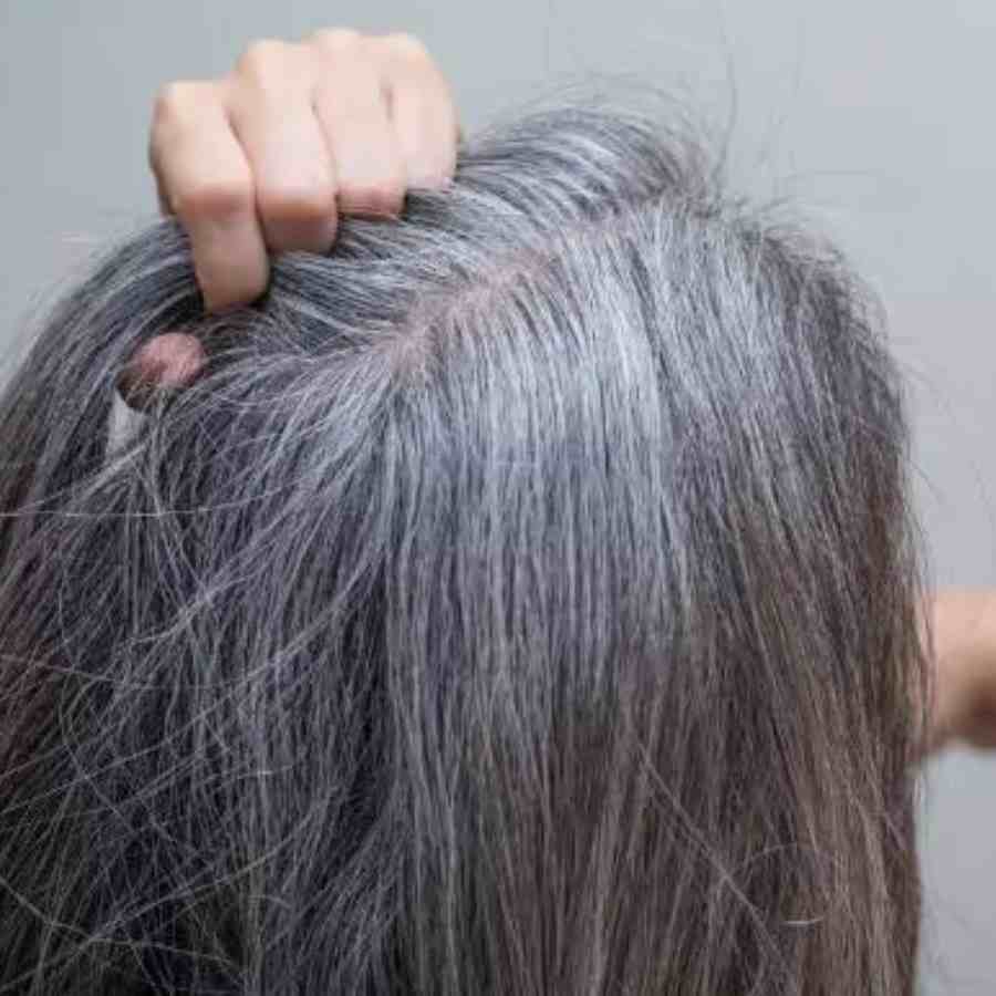 What you should mix with mustard oil to stop grey hair dgtl