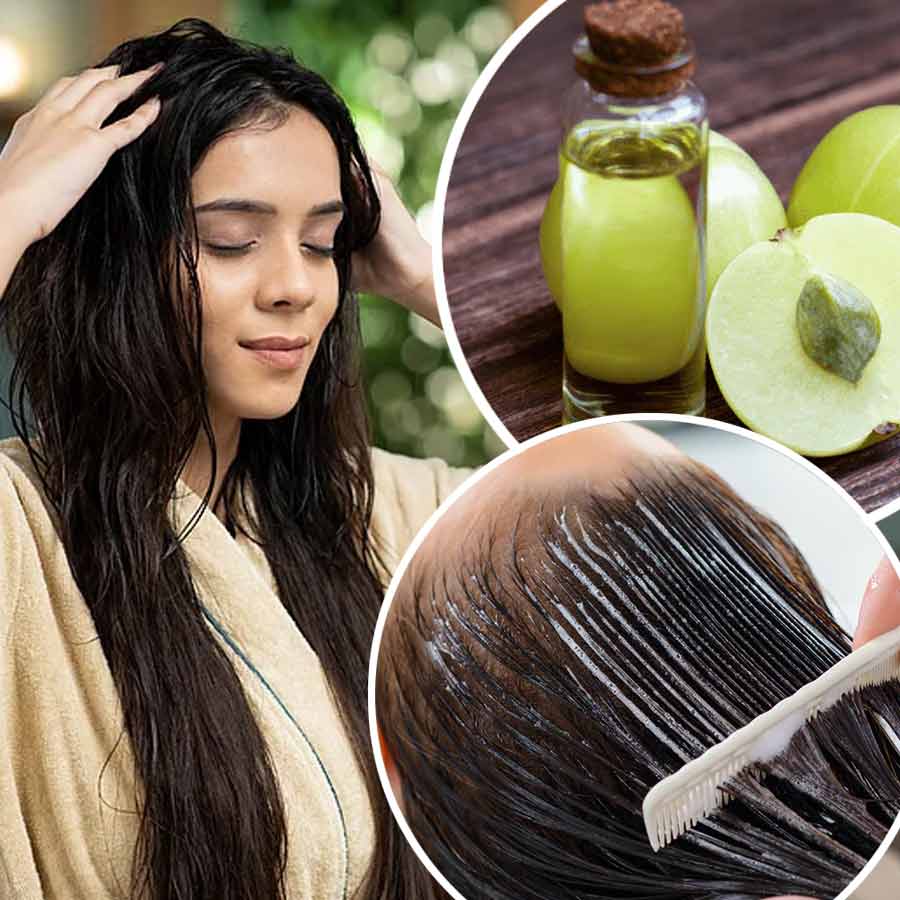 Amla or goosebery oil, mask or shots which form is best for healthy hair dgtl